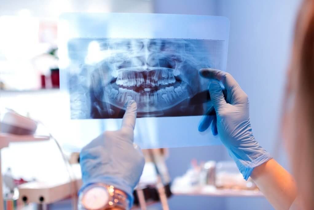 Dental Digital X-ray in Mayur Vihar Phase-3