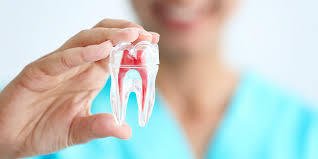 Root Canal Treatment in Mayur Vihar Phase-3