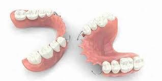 Removable Partial Denture in Mayur Vihar Phase-3