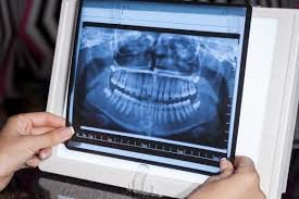 Best Dental X-ray in Kondli : Comprehensive Care at Ambey Dental Clinic