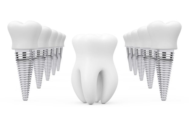 Best Dental Implant in Mayur Vihar