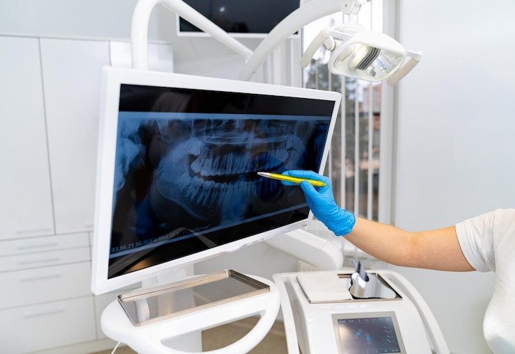 Best Dental Digital X-ray in Mayur Vihar