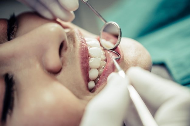 Expert Root Canal Treatment in Mayur Vihar