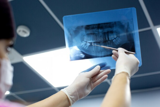 Best Dental Digital X-ray Centre in Ashok Vihar