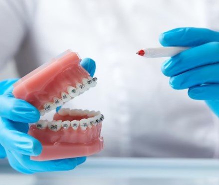 Best Removable Partial Denture in Ashok Vihar