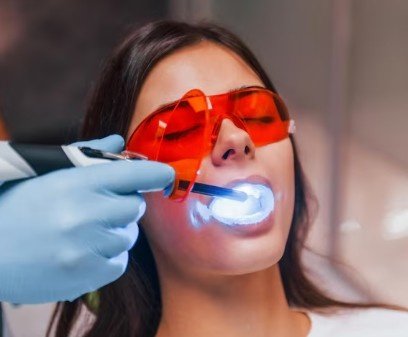 Best Teeth Whitening Service in New Delhi