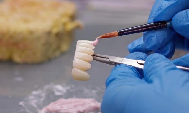 Best Teeth Cement Restoration in New Ashok Nagar