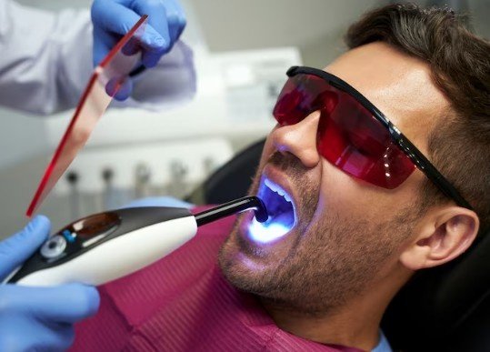 Best Teeth Whitening Service in New Ashok Nagar