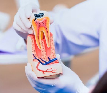 Best Root Canal Services in Ashok Vihar