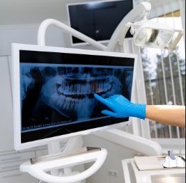 Best Dental X-ray Centre in Noida