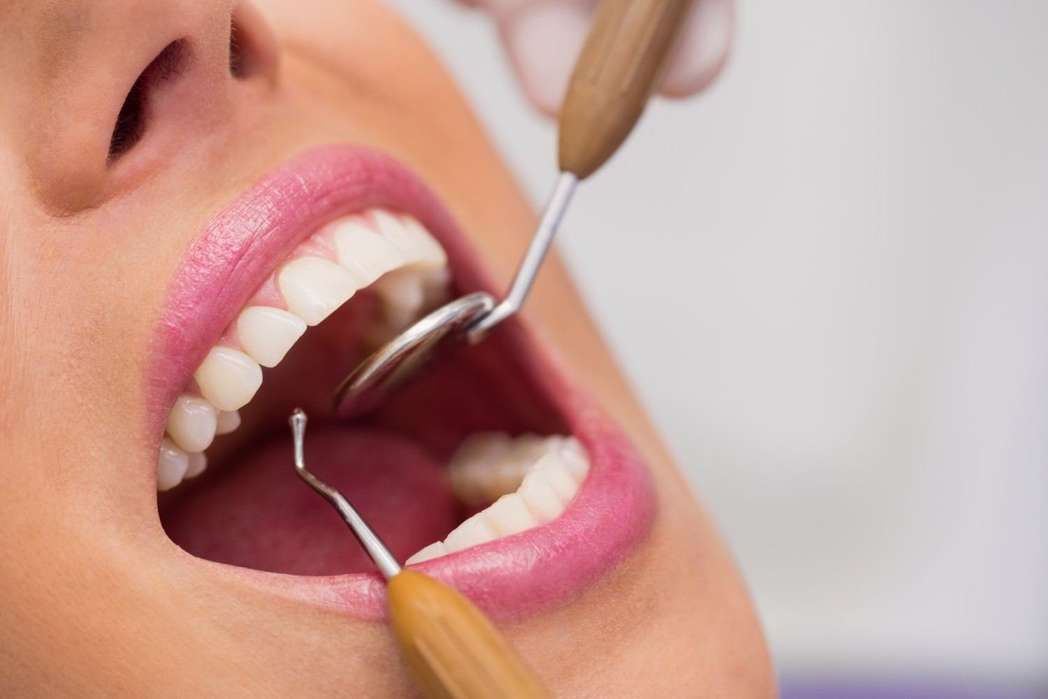 Teeth Cleaning in Mayur Vihar Phase 3