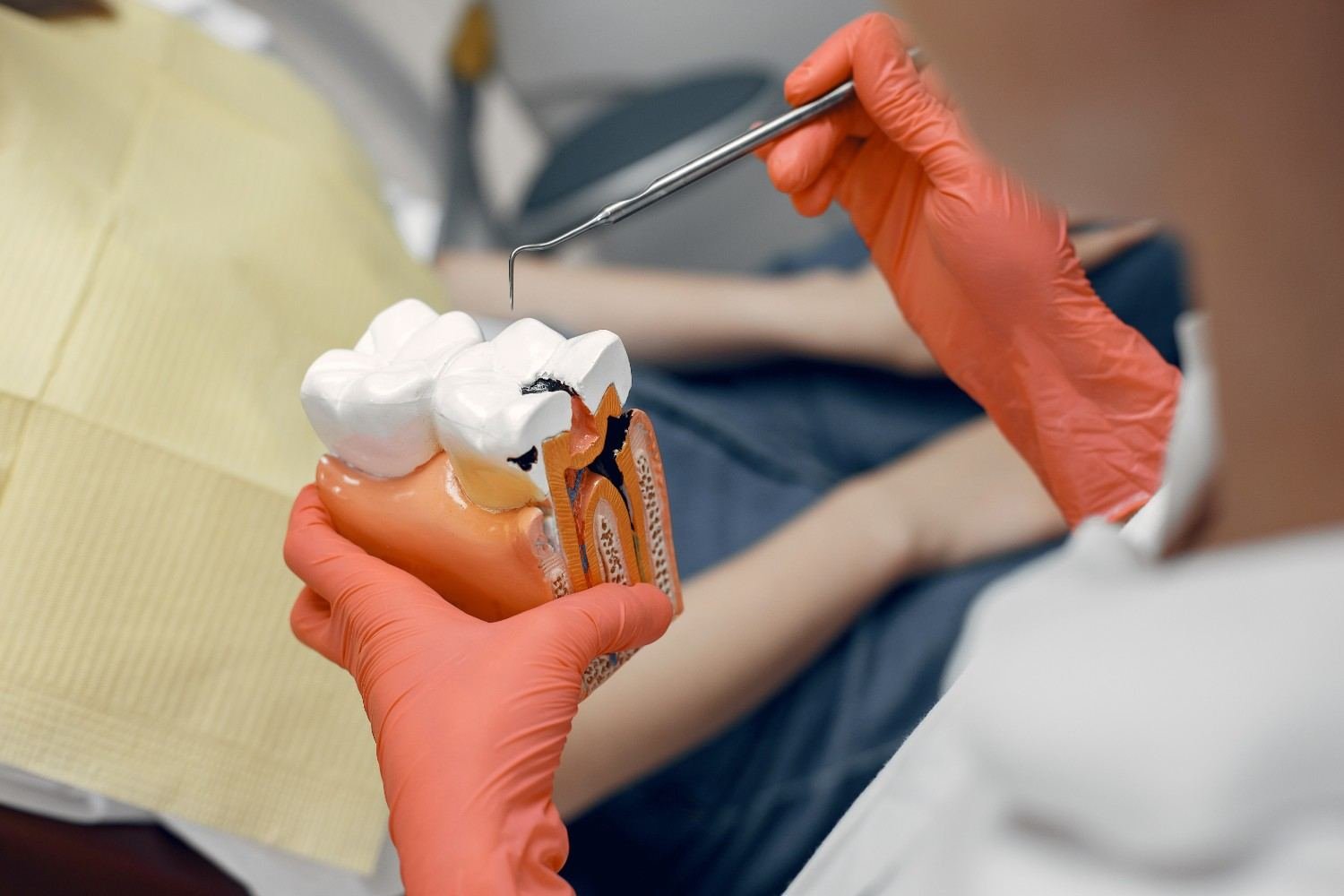 Root Canal Specialist in Mayur Vihar