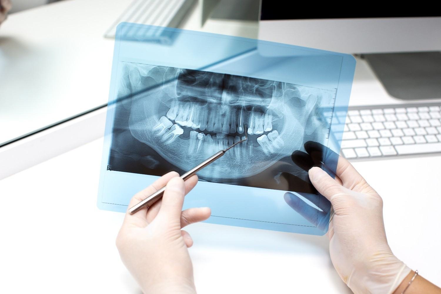 Dental Digital X-ray in East Delhi