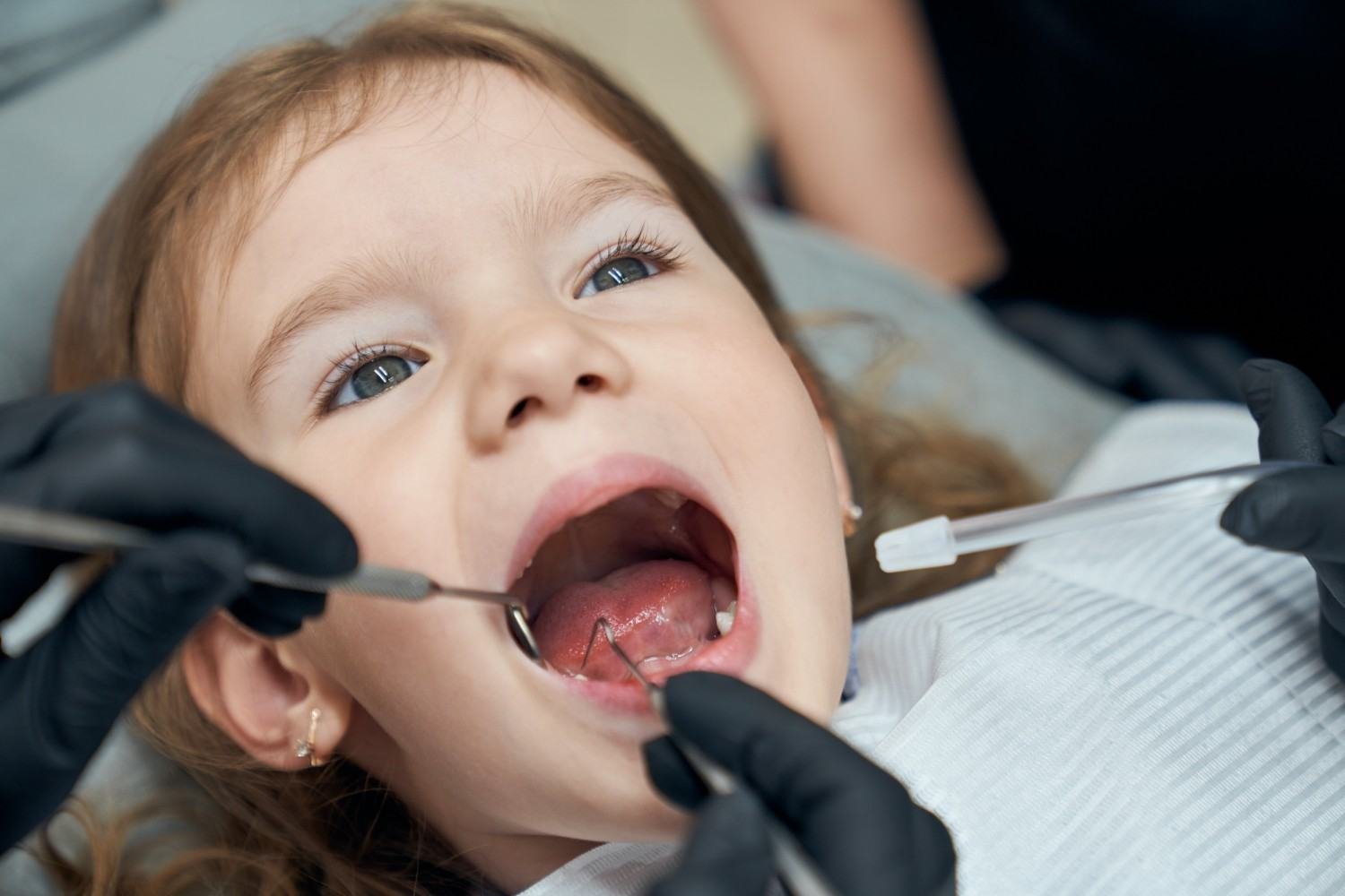 Kids Dentistry in New Delhi